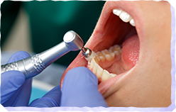 プロフェッショナルクリーニング