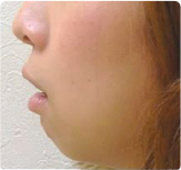 口で呼吸をする人の顔の形と口元