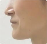 鼻で呼吸をする人の顔の形と口元