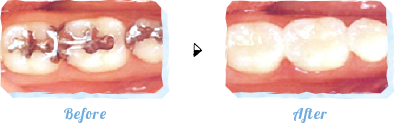 セレックBefore After