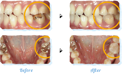 セレックとは Before After
