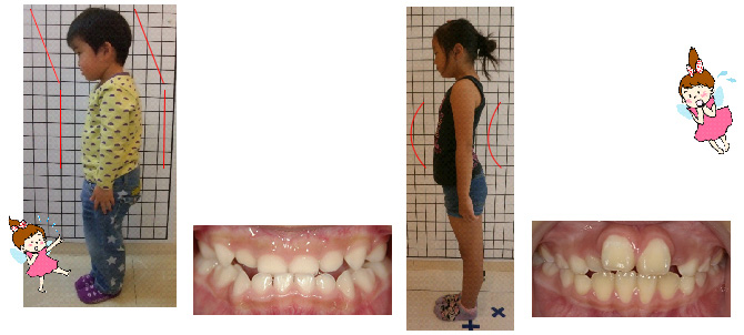 姿勢が悪いと歯並びも悪くなる正しい姿勢はきれいな歯並びの絶対条件です！